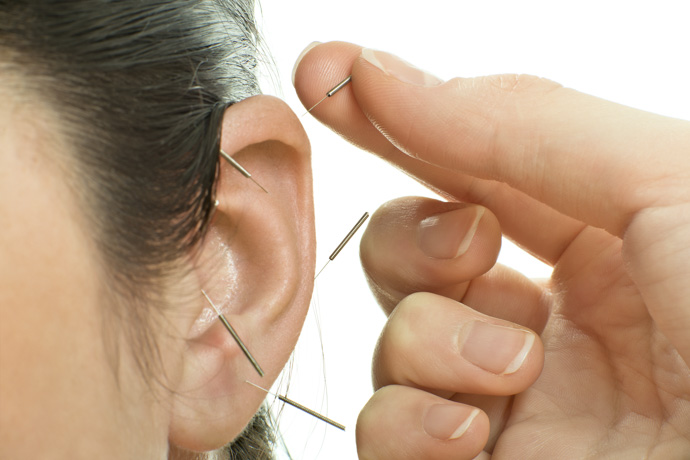Acupuntura en las orejas para dejar de fumar