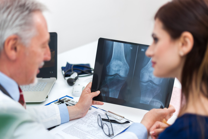 Médico explicando a paciente cómo prevenir la osteoporosis en las rodillas.