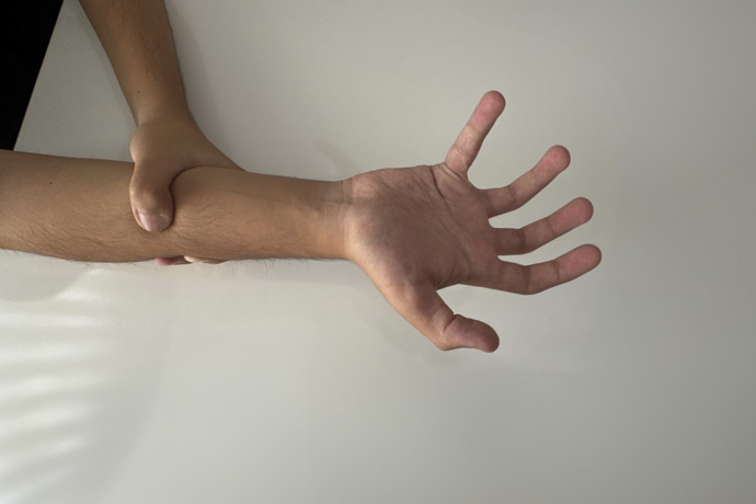 Persona joven con síndrome de mano ajena