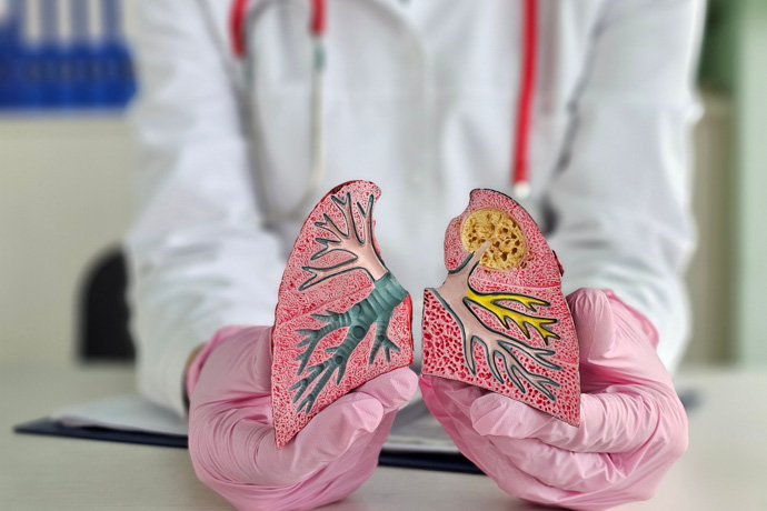 Médico explica efectos negativos de fumar