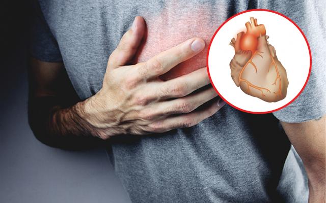 aneurisma aórtico torácico