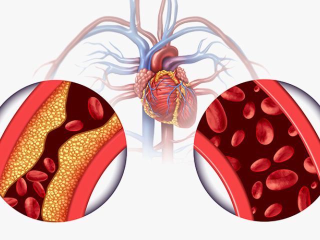 Inhibidores de ECA para la tensión arterial