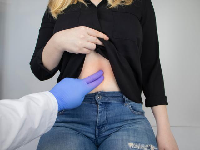 Gastroenterólogo hace diagnóstico de duodenitis